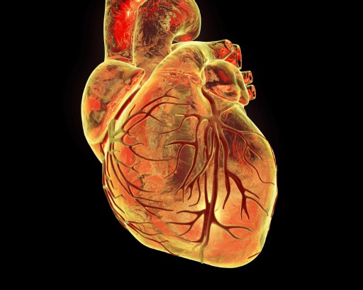 Heart with coronary blood vessels, computer illustration.